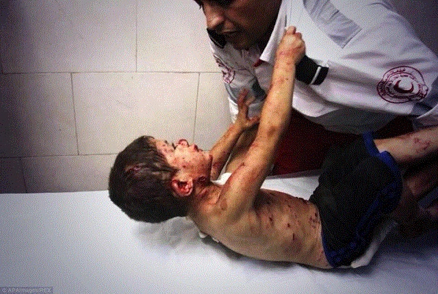 Boy injured in an Israeli strike clinging to a medic at al-Shifa hospital - Ezz al-Zanoun - APA images